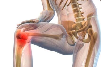 Kniegelenks -Osteoarthritis